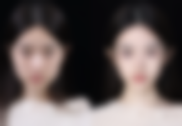 五、沈阳浑南丽格医疗整形美容实例