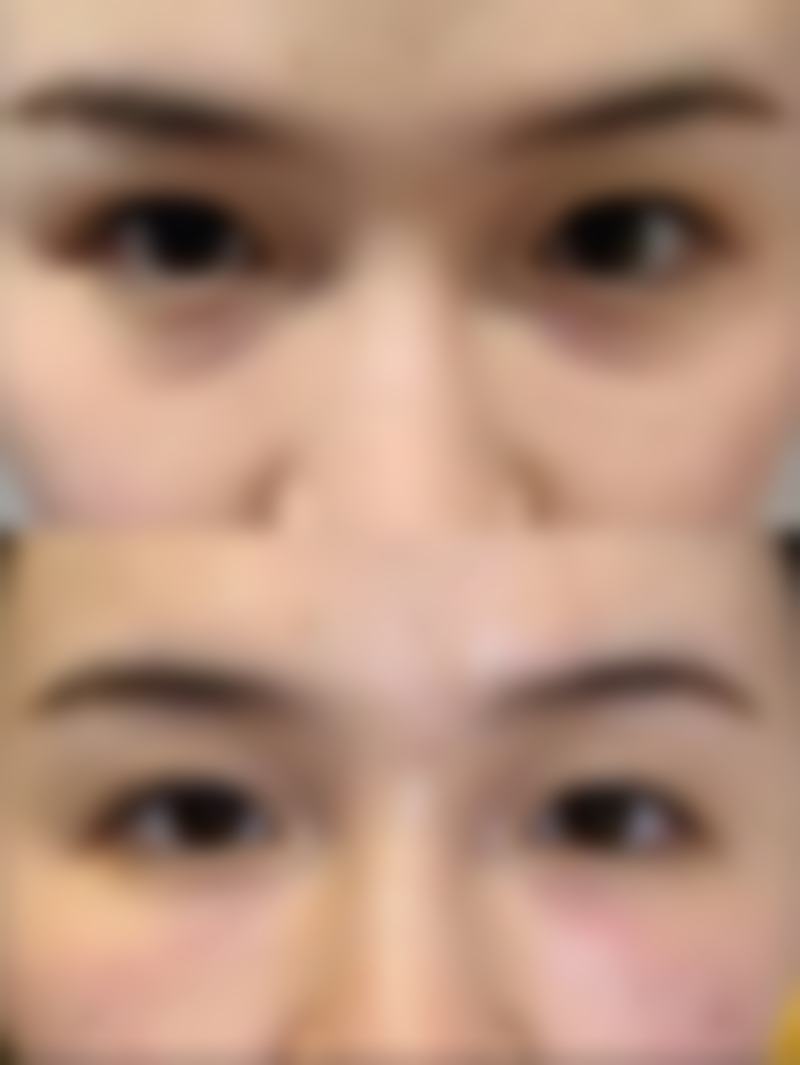 四、佳木斯李红石整形医疗美容科诊所实例