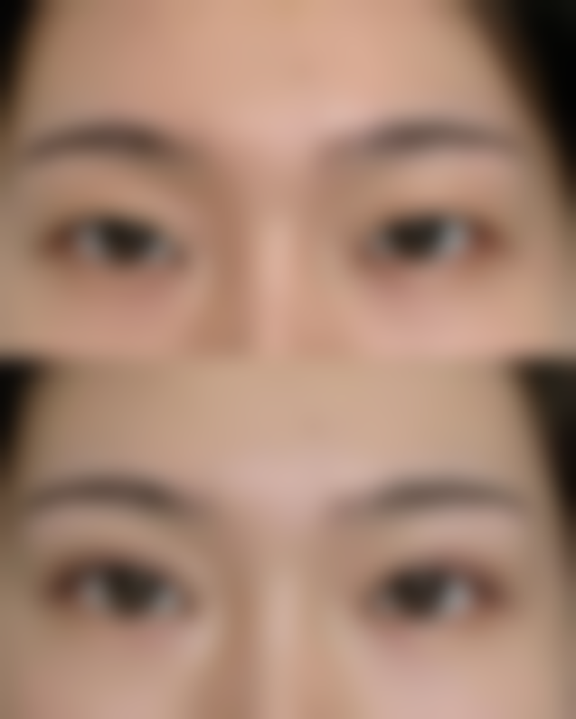 六、周口雅美天成医疗美容门诊部价格表：（仅供参考）