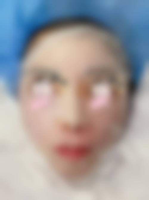 翟笃诚医生项目价格表参考