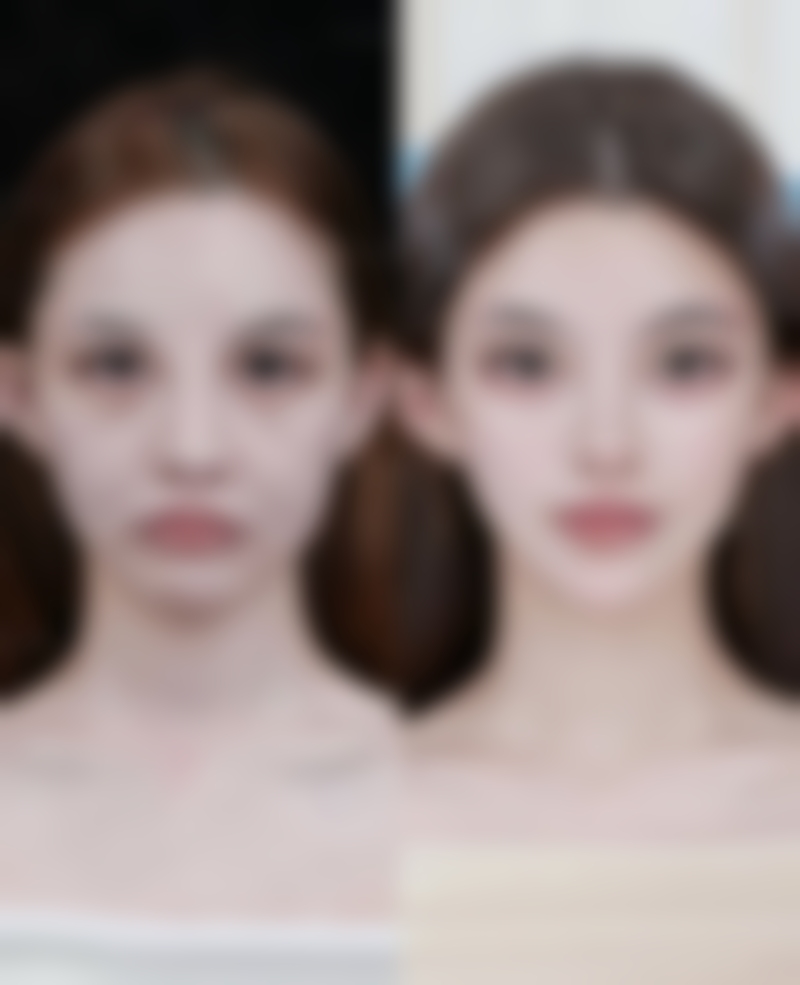 割双眼皮前需留意啥？做好身体检查特别必要