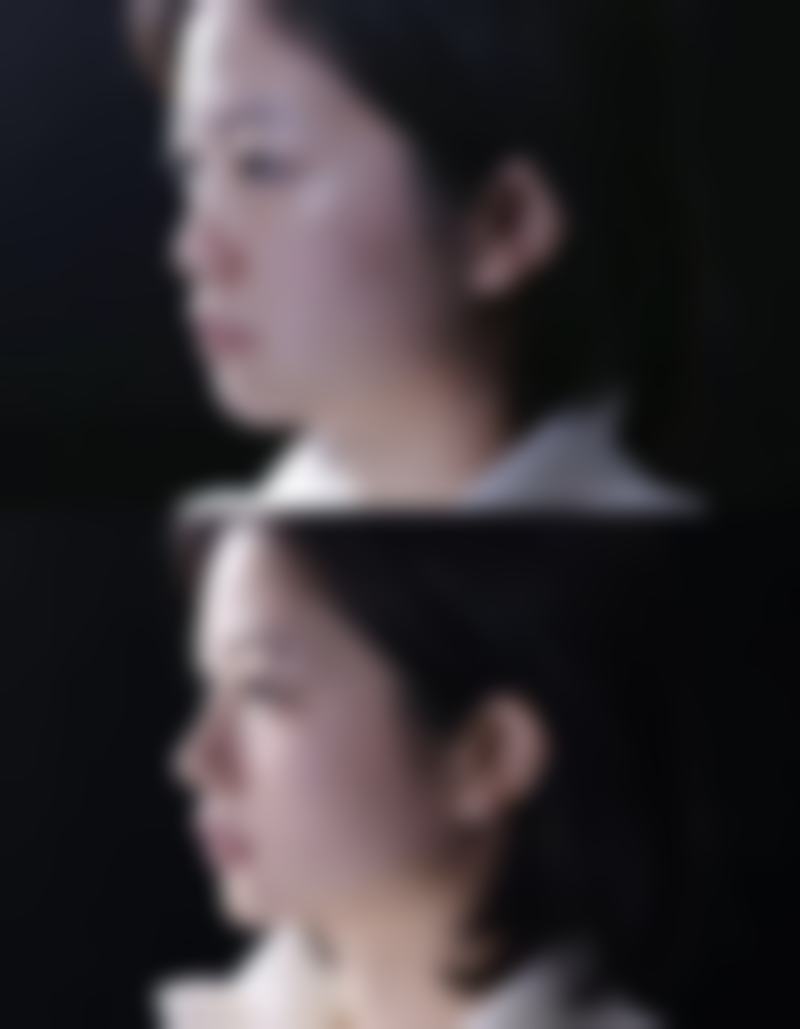 八、丽水市人民医院整形外科真实的顾客评价如下：