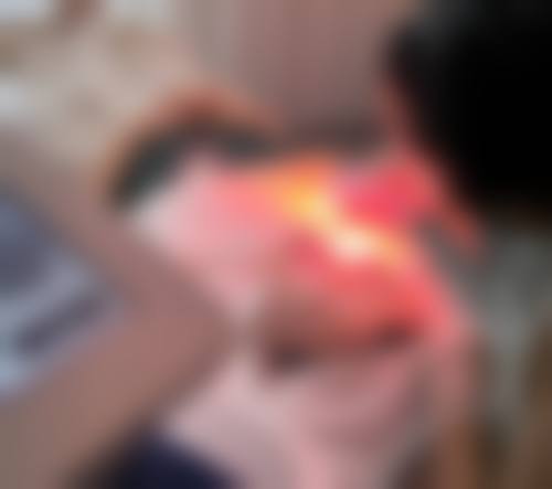 白亚亚医生在哪家医院怎么预约？