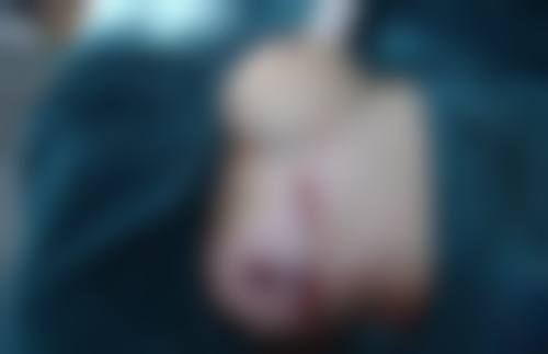 守护美胸，假体隆胸喂奶也能美美哒