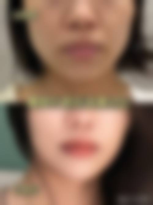 三、合肥爱春医疗美容诊所医生介绍: