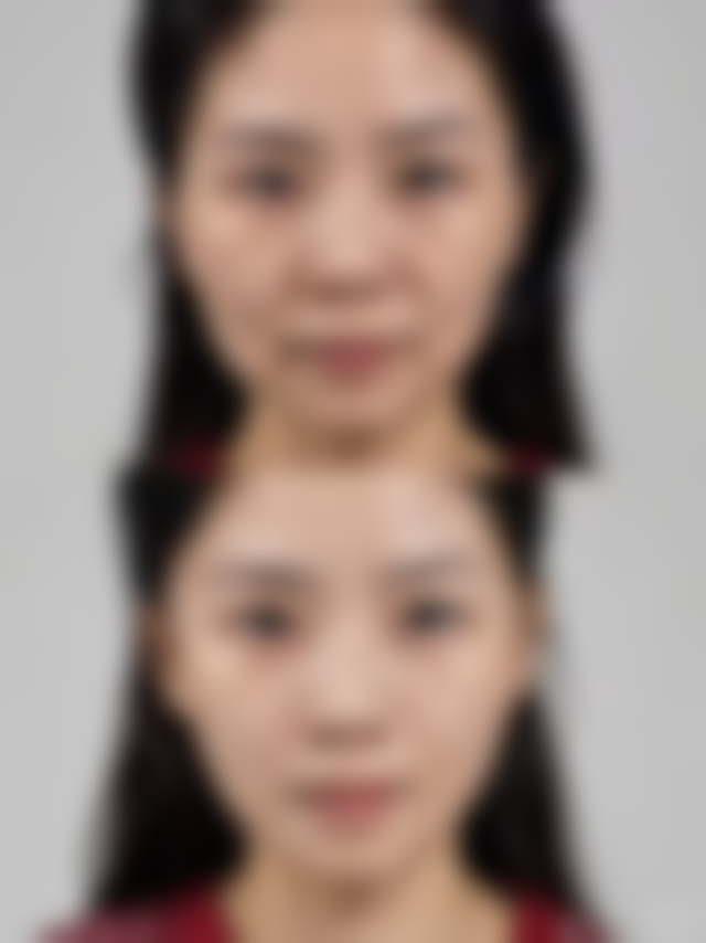 八、张家界瑞美整形门诊部真实的顾客评价如下：