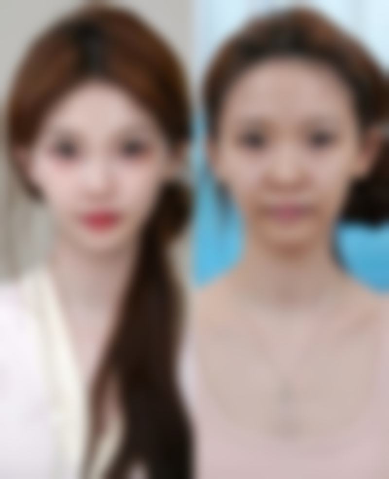 五、玉林市第二人民医院整形美容科实例
