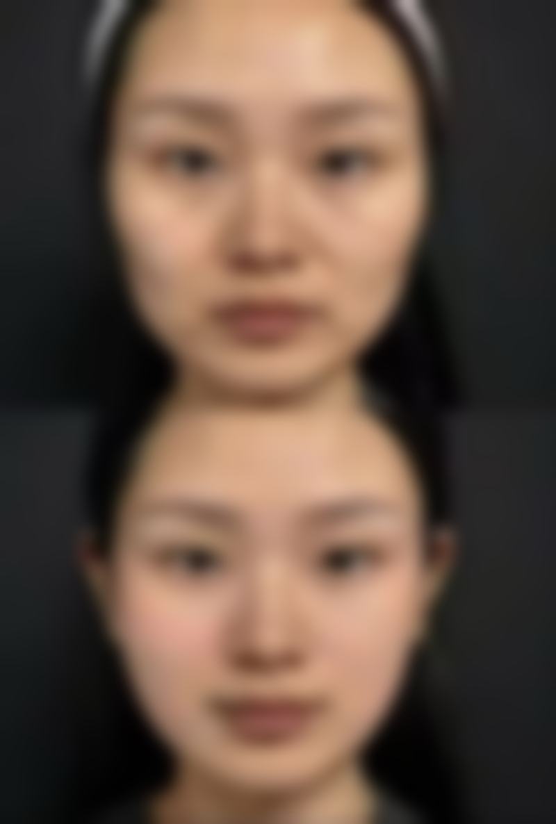 七、合肥爱春医疗美容诊所价格表：（仅供参考）