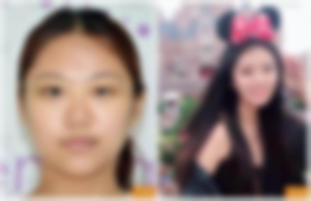 北京禾美嘉医疗美容门诊部李梦莹：选择她的理由总结