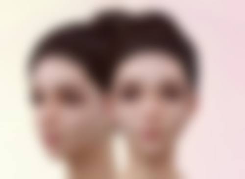 切开双眼皮太宽别怕，知晓过宽诱因