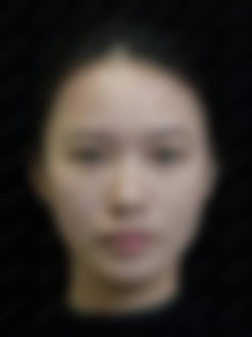 八、南昌艾莱芙医疗美容医院真实的顾客评价如下：