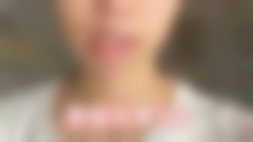 五、达州紫蝴蝶整形美容实例