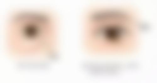 术后通用护理建议