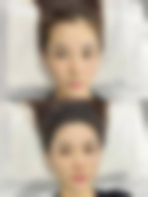 五、甘肃宝石花医院烧伤整形科实例
