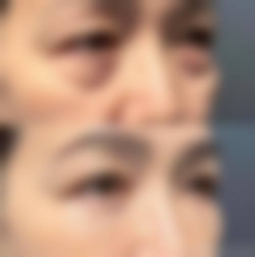 八、香港壹美健整形医疗美容门诊部真实的顾客评价如下：