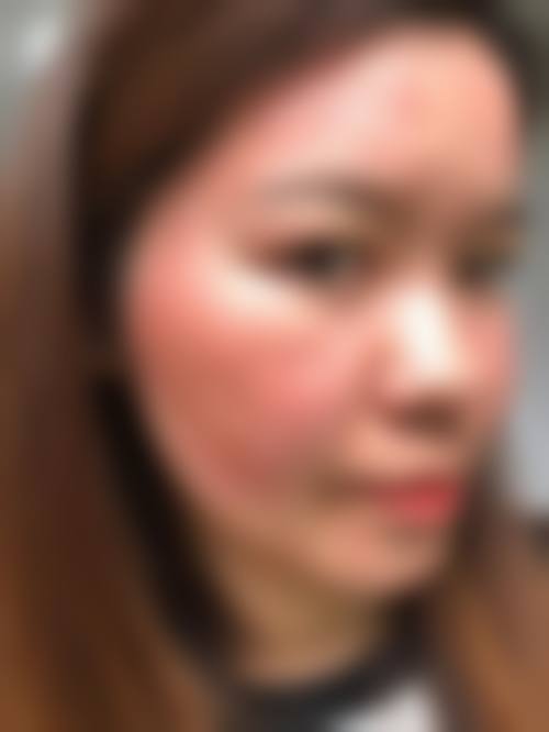 五、昆明比尔西希医疗美容诊所实例