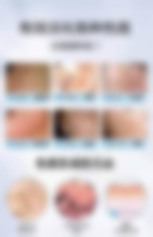 八、新疆维吾尔医医院皮肤美容科真实的顾客评价如下：
