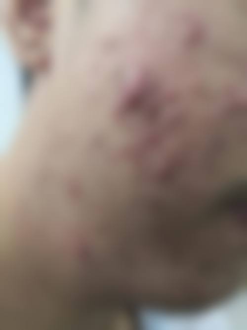 童惠医生在哪家医院怎么预约？