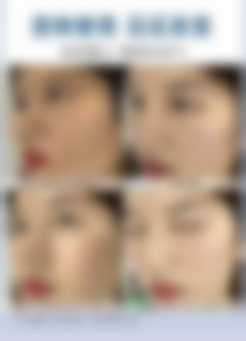 八、陕西榆林初妍盛开整形医院真实的顾客评价如下: