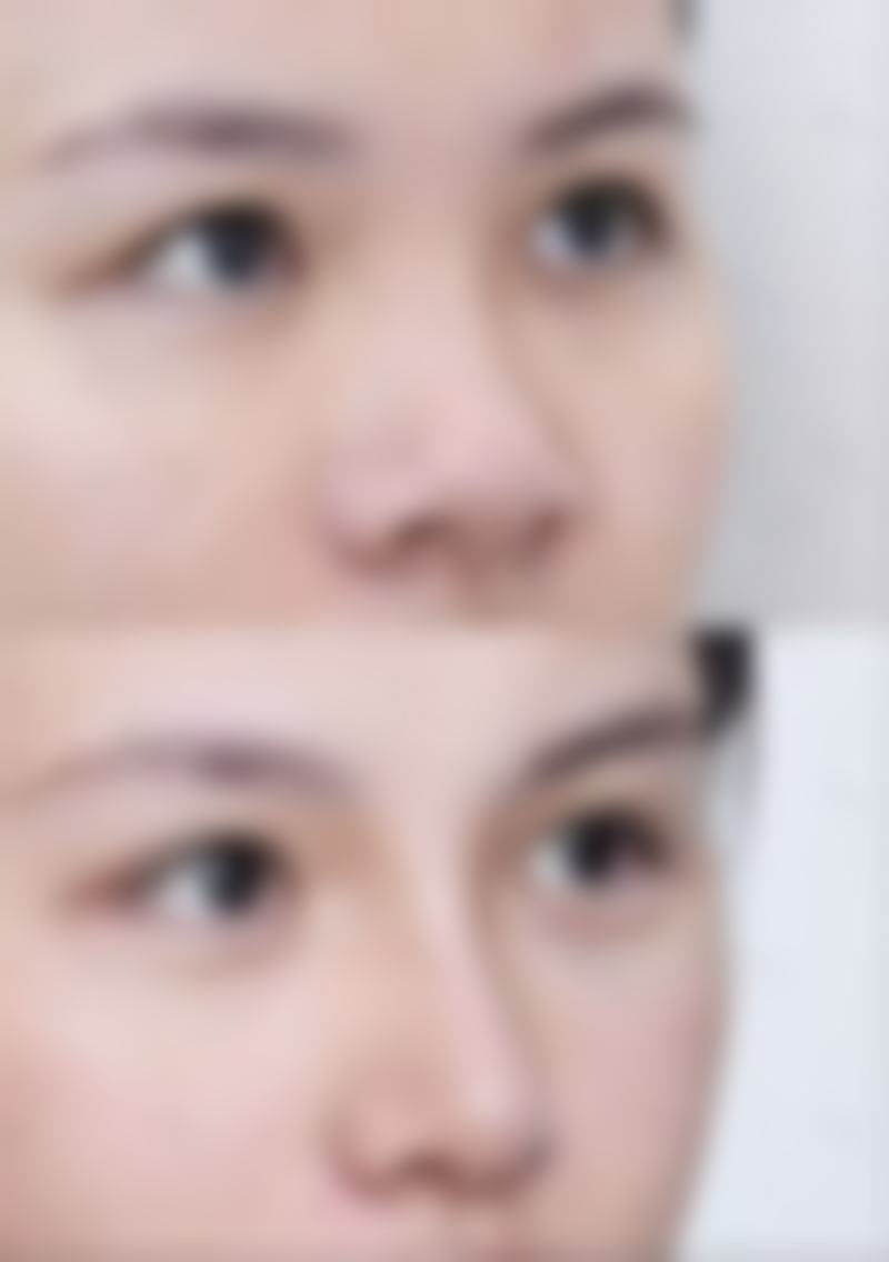 五、北京京喜医疗美容诊所实例