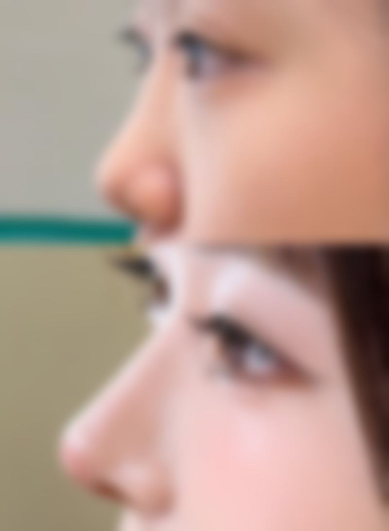 朗昆医生在哪家医院怎么预约？