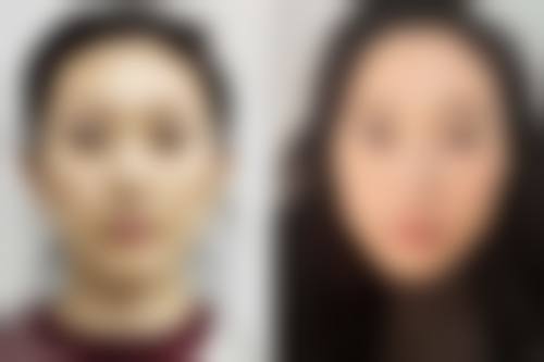 五、南京颜小美医疗美容门诊部实例