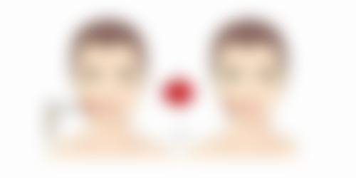 脸部划伤疤痕何时消失？深度、体质、护理决定周期，科学干预加速淡化 