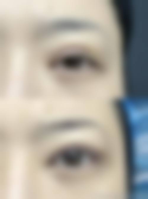 七、广西科技大学第一附属医院(医疗美容整形外科)价格表：（仅供参考）