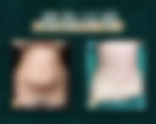 广州高尚医学美容中心余文林会亲自做手术吗？20 余年经验院长亲诊，个性化方案打造自然美