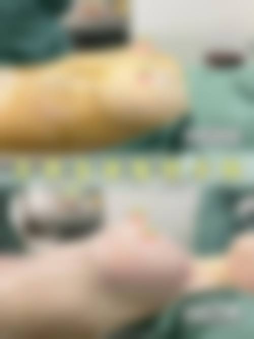 八、福州优美整形医疗美容诊所真实的顾客评价如下：