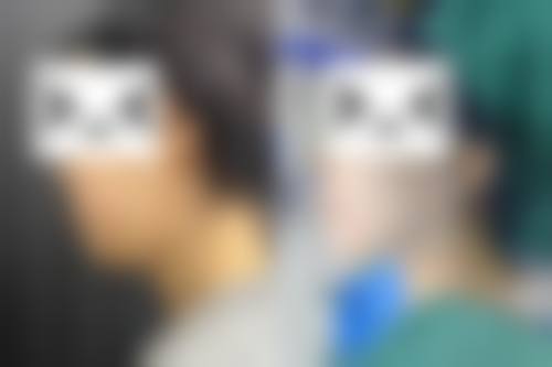 五、北京摩尔星美整形医院怎么预约：