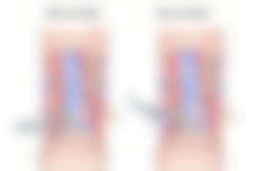 如何按摩眼睛减眼袋?热敷辅助按摩增强成效