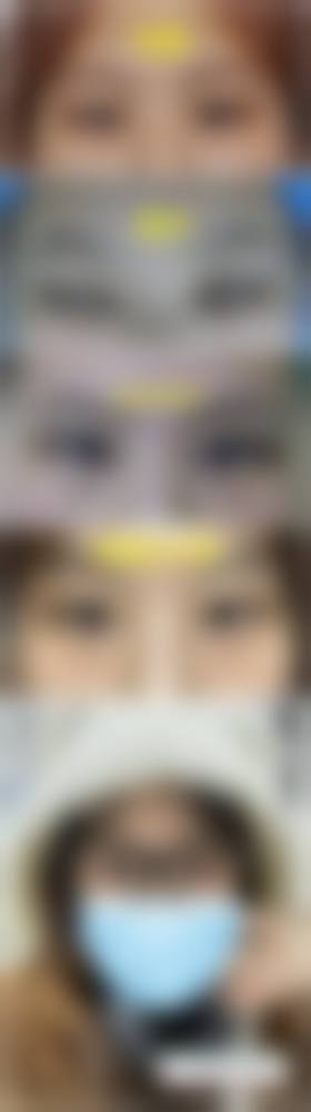 八、西安爱熙医疗美容诊所真实的顾客评价如下: