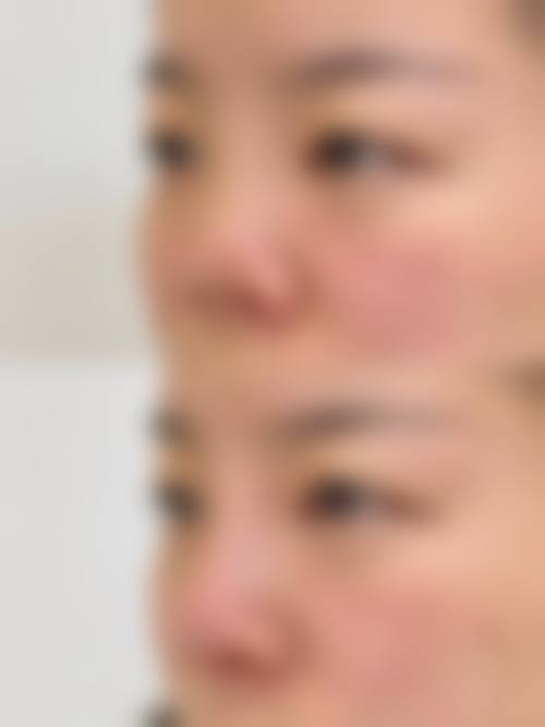 文丰医生项目价格表参考
