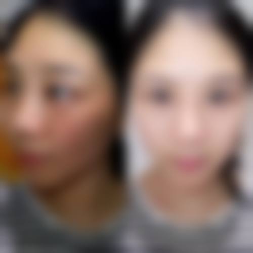 七、韩国MyQueen整形皮肤科价格表：（仅供参考）