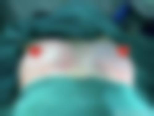 五、包头百悦(原时光)整形美容医院实例