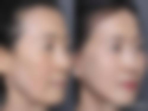 六、潜江市中 心医院整形美容科怎么预约: