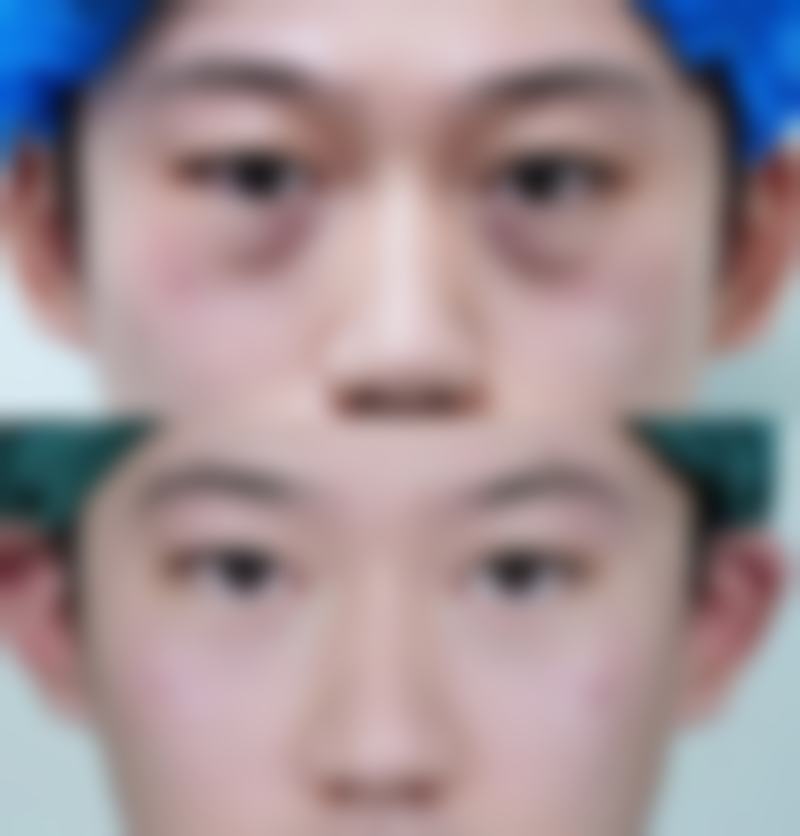 五、潜江市中 心医院整形美容科实例