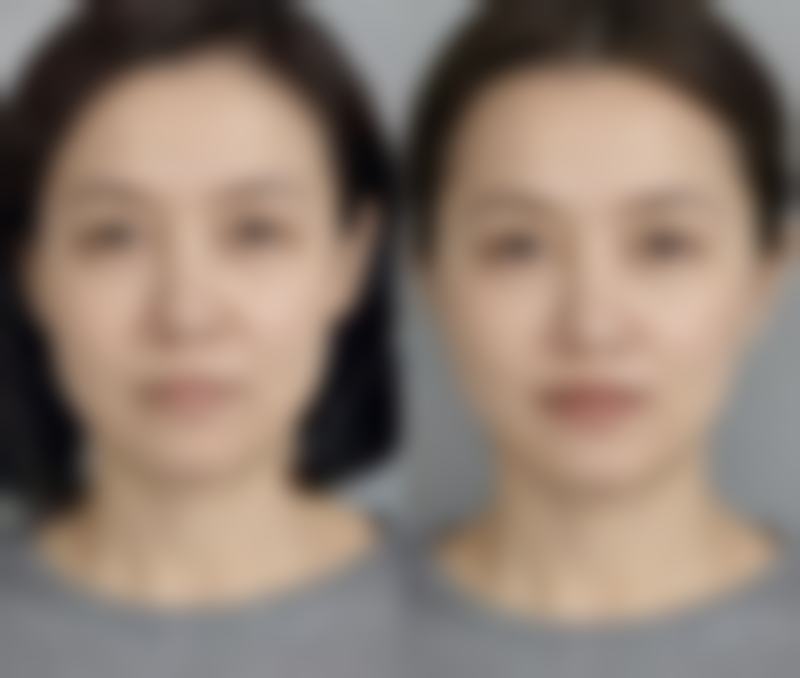 抽脂总耗时情况