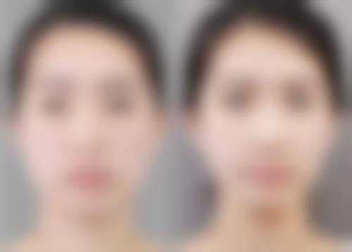 八、荆门和丽整形美容门诊部真实的顾客评价如下：