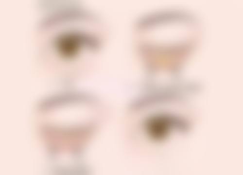 揭秘！组织去除过度，双眼皮显老没商量