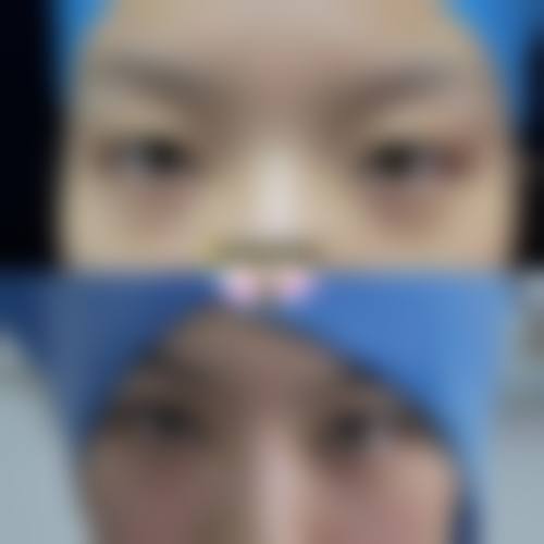 五、广州迦妍医疗美容门诊部怎么预约：