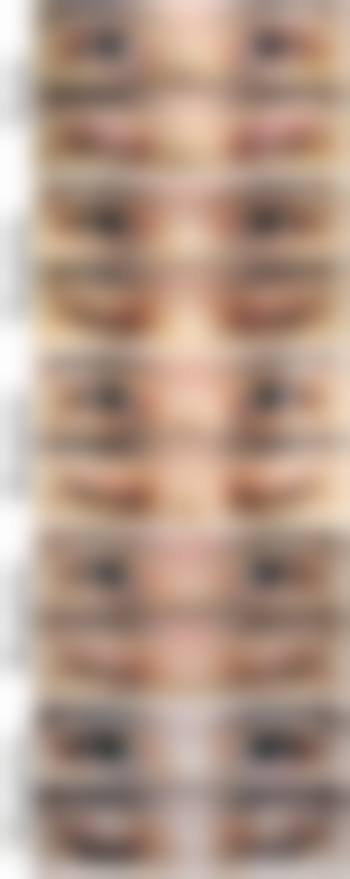 五、宜昌市博美整形美容医院实例