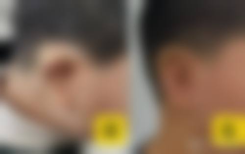 周婕医生实例