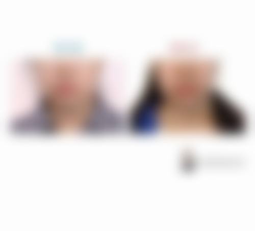 七、韩国首尔第一整形医院价格表：（仅供参考）