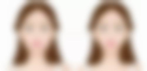 辨证分型论治：精细治疗成效好