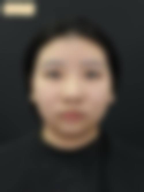 七、三亚梦妮幻医学整形美容诊所真实的顾客评价如下:
