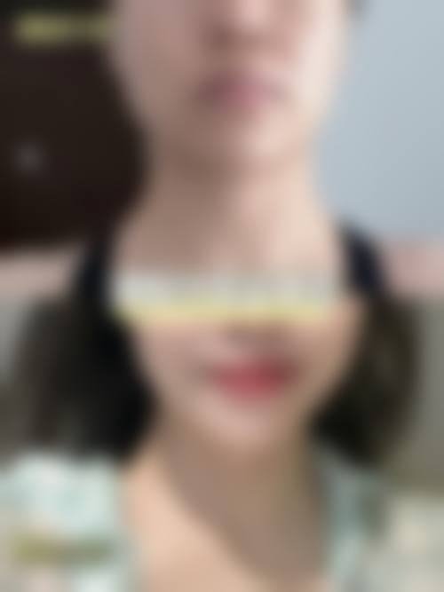 刘华荣医生实例