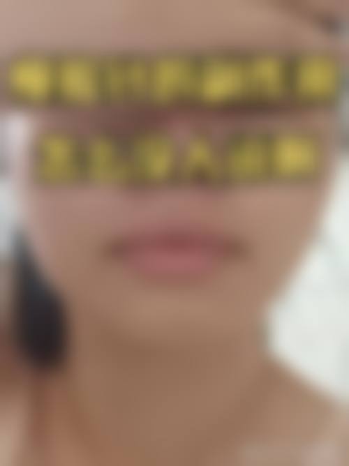 刘华荣医生在哪家医院怎么预约？