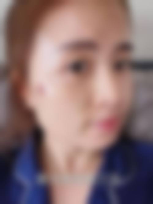 五、海口九久医疗美容门诊部实例